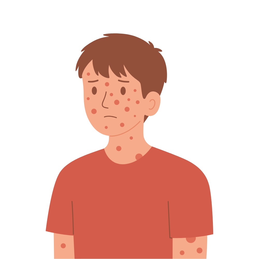 Skin Disease