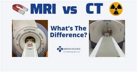 MRI vs CT Scan Explained